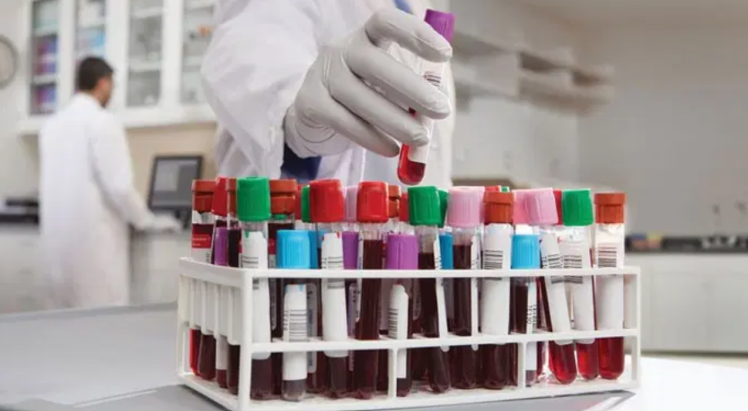 آماده سازی نمونه التراسونیک برای TEM، SEM، GC، FTIR، XRD
