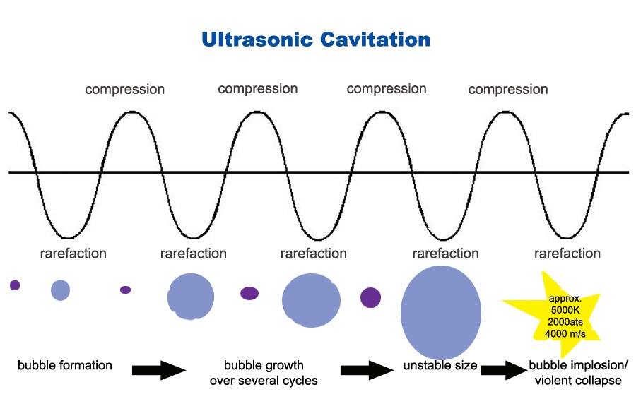 کاویتاسیون التراسونیک